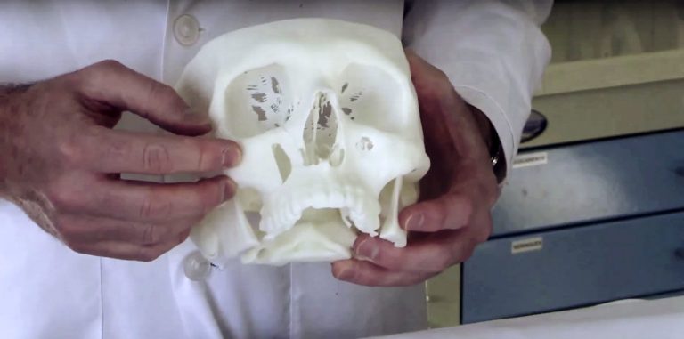 С помощью 3D-печати была проведена сложная лицевая реконструкция