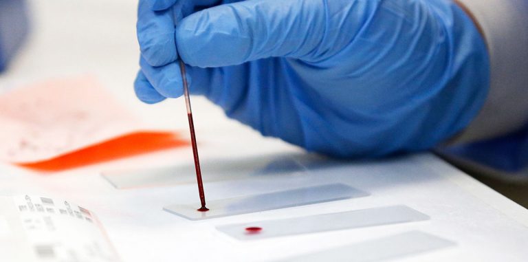 В России создали прибор для анализов по капле крови, как у Theranos