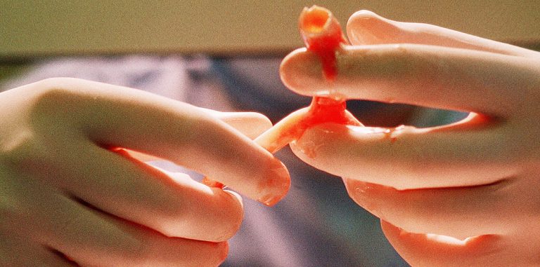 Напечатанные на 3D-принтере кровеносные сосуды прижились за 7 дней