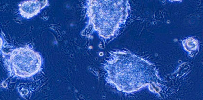 В&nbsp;Японии впервые проведут пересадку сетчатки с&nbsp;донорскими iPS-клетками