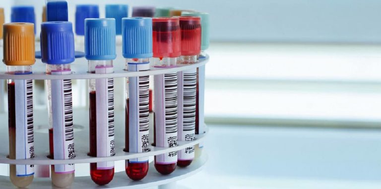 CancerLocator определяет тип и локализацию рака по анализу крови
