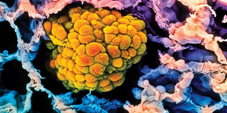 Китайские ученые испытают CRISPR на человеке
