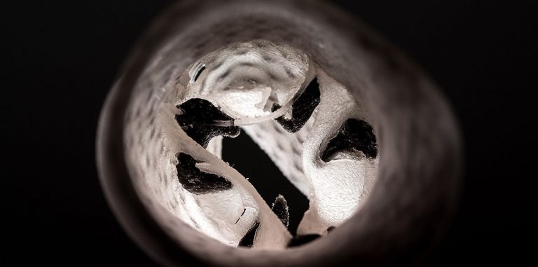 Ученые тестируют искусственные сердечные клапаны на 3D-модели