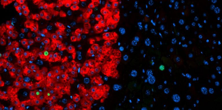 Ученые смогли научить кожные клетки производить инсулин