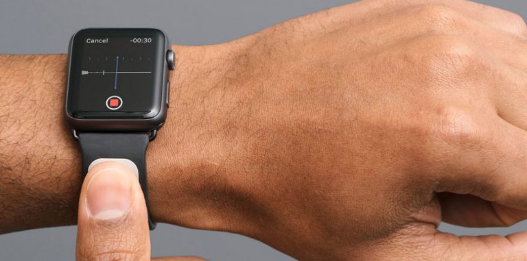 Кардиобраслет Kardia Band работает лучше, чем Apple Watch