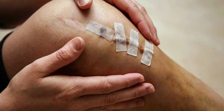 Разработана технология, ускоряющая заживление ран