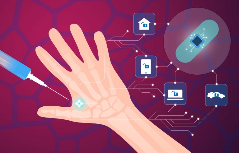 Iota Biosciences разработала имплантируемый фитнес-трекер размером меньше рисового зерна