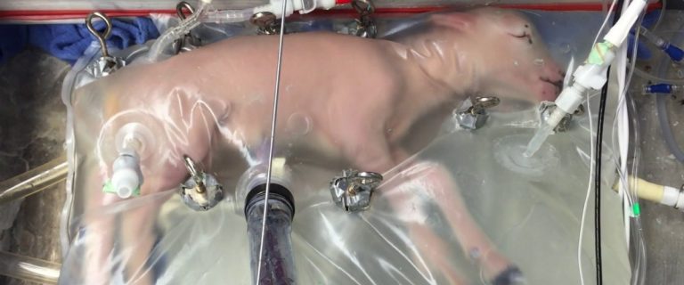 Искусственная матка появится в больницах в течение пяти лет