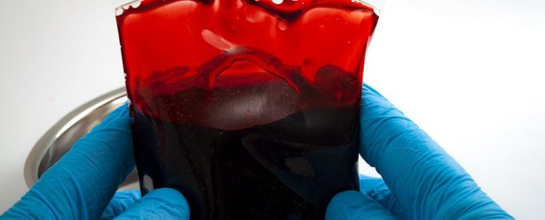 Медики попробуют создать вакцину от Covid-19 из антител выздоровевших пациентов