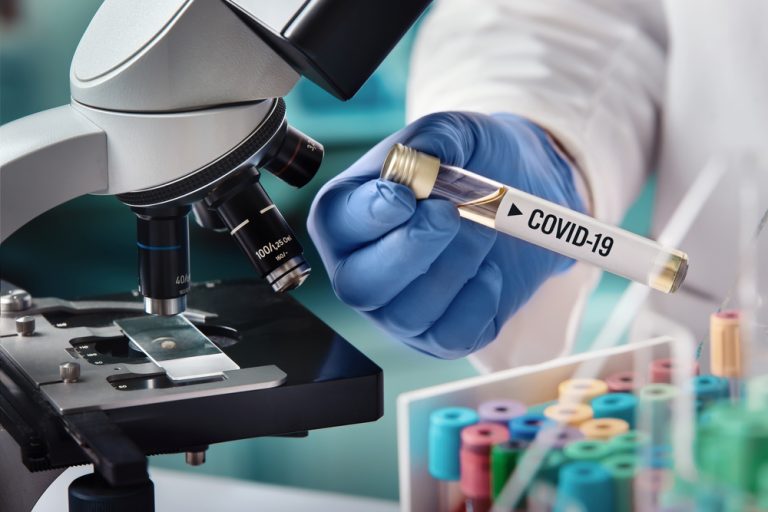 Биологи создали новый тест на COVID-19. Из реагентов, которые пока не в дефиците