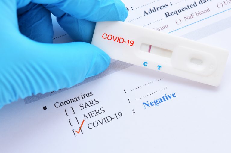 Ученые нашли коронавирус в сперме заразившихся COVID-19 пациентов