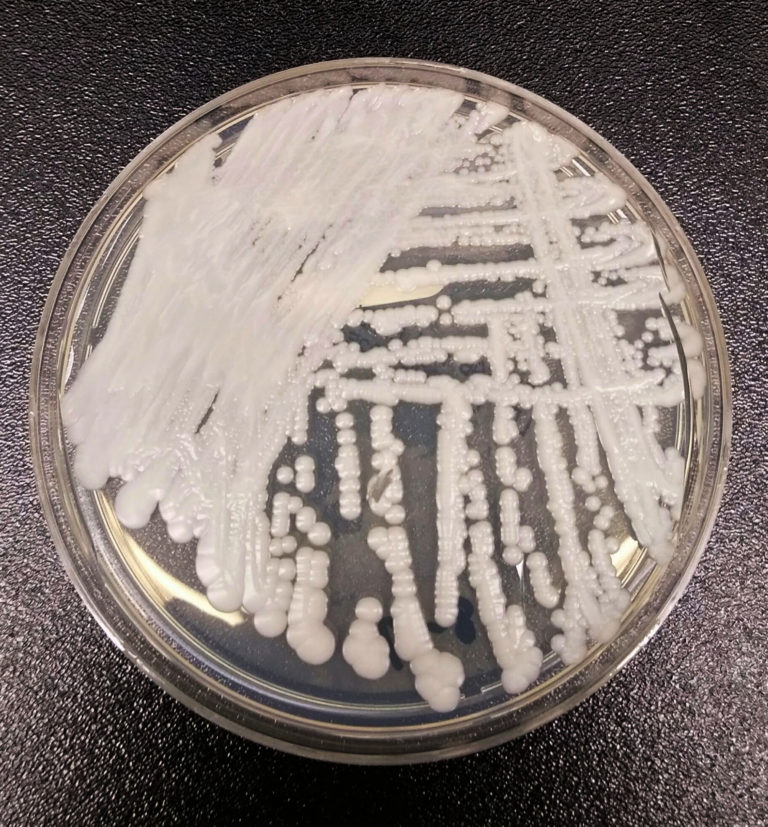 Больничный супергрибок Candida auris обнаружен на пляже удаленного острова