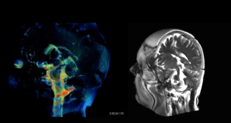 Новая 3D-визуализация показывает, как пульсирует мозг человека