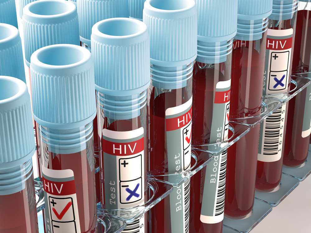 Исследователи придумали как «вырвать» ВИЧ из организма