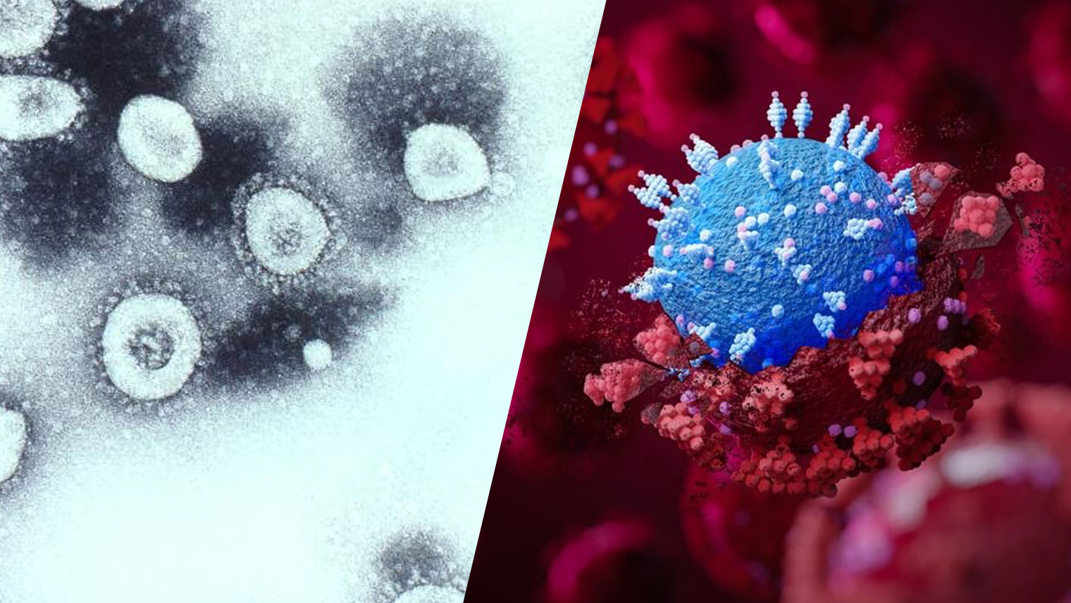 Первая пандемия коронавируса была 130 лет назад: ученые исследуют «русский грипп» XIX века