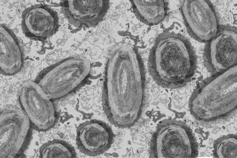 The Lancet: против оспы обезьян впервые использовали противовирусные