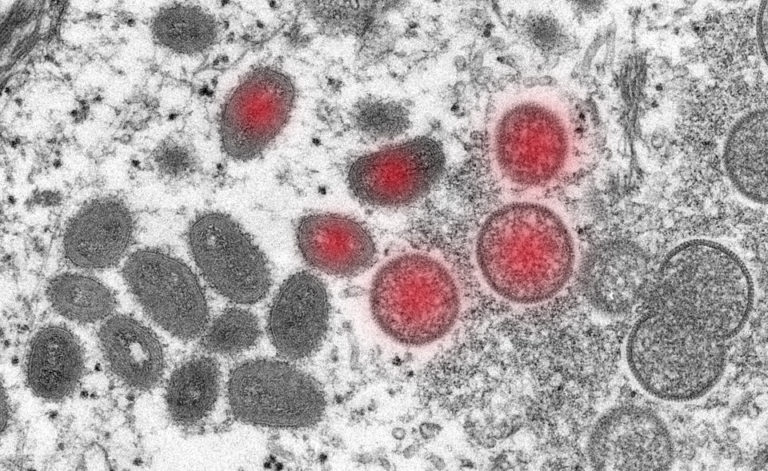 Оспа обезьян распространяется по миру, но ученые не понимают как. Будет новая пандемия?
