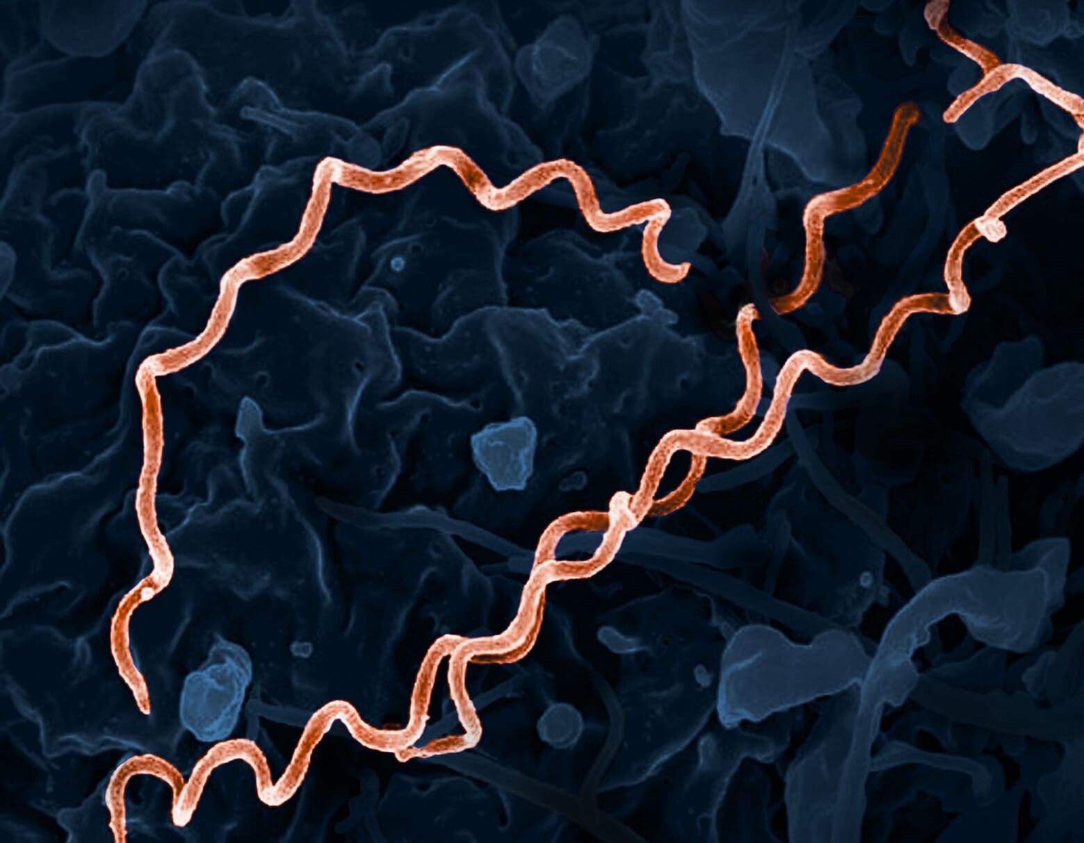 Микробиологи пересматривают происхождение сифилиса в Европе: Колумб не виноват