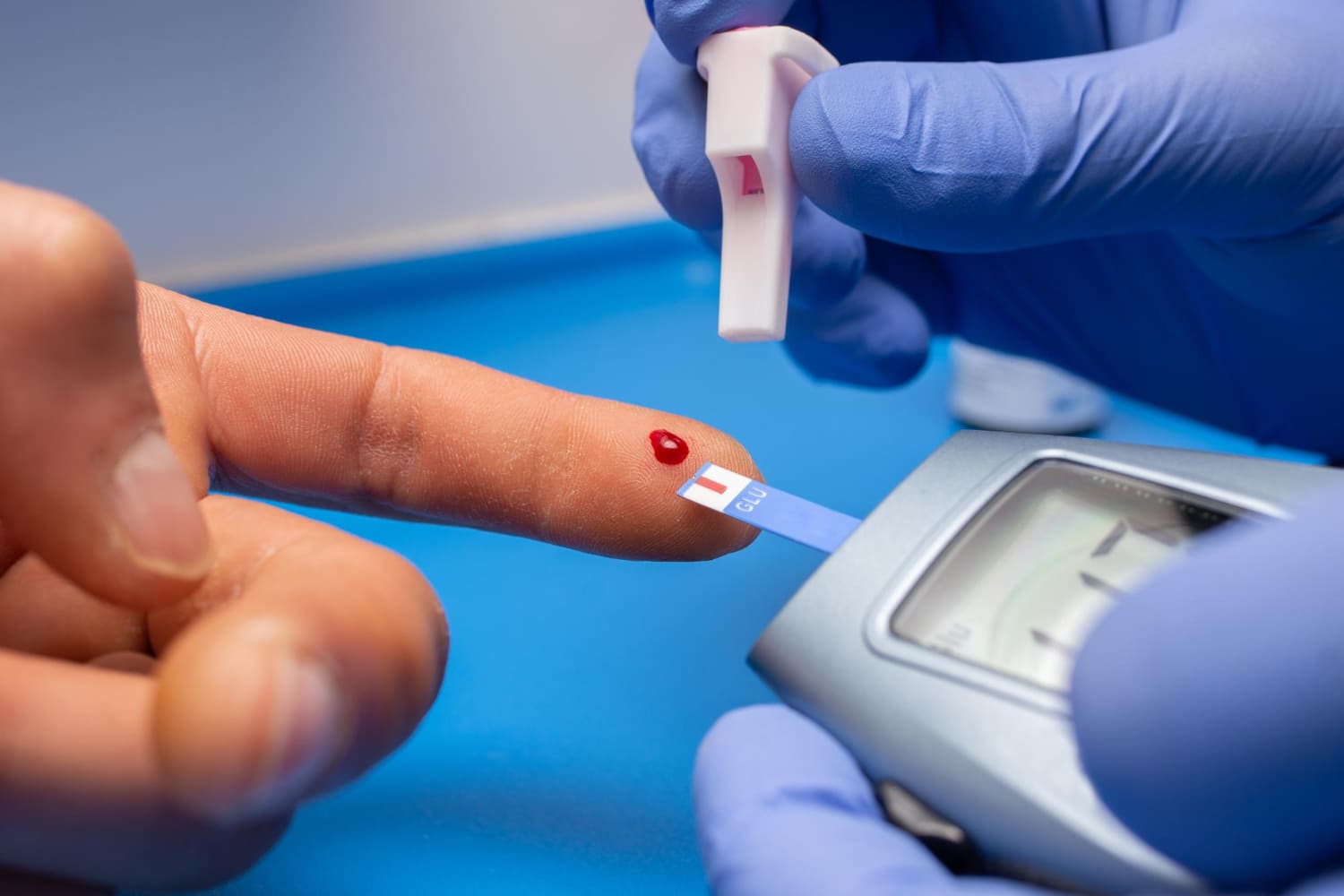 Исследователи объяснили, почему раны при диабете заживают медленно