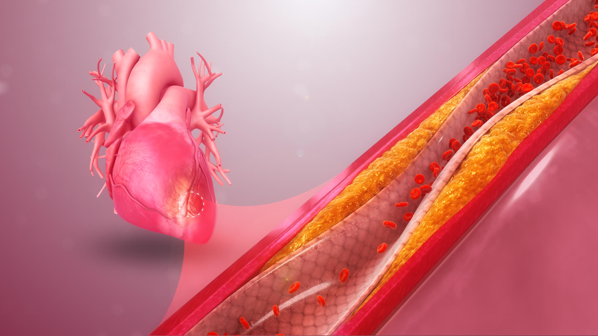 Ученые придумали, как лечить сердце двумя витаминами на генетическом уровне