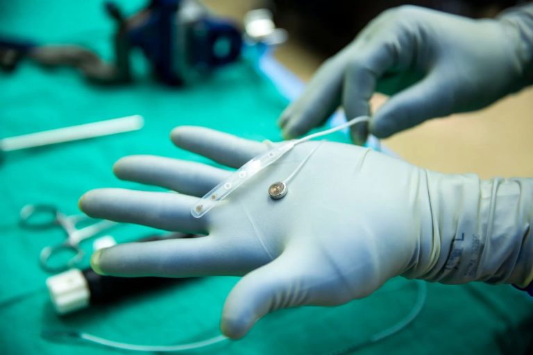 Конкурент Neuralink впервые испытал мозговой имплантат на человеке