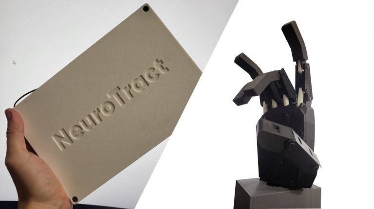 Студент из Казани разработал систему управления бионическим протезом руки