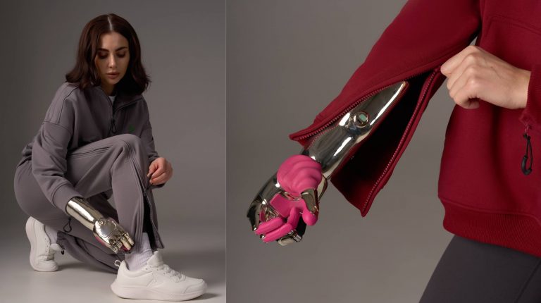 «Группа Моторика» представила первый российский модуль локтя для бионических протезов