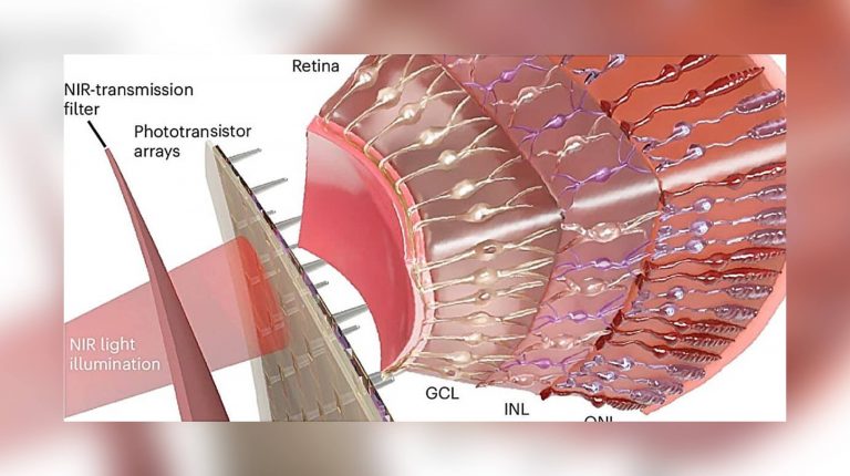 Ученые создали мягкий глазной имплантат для мышей — он реагирует на инфракрасный свет