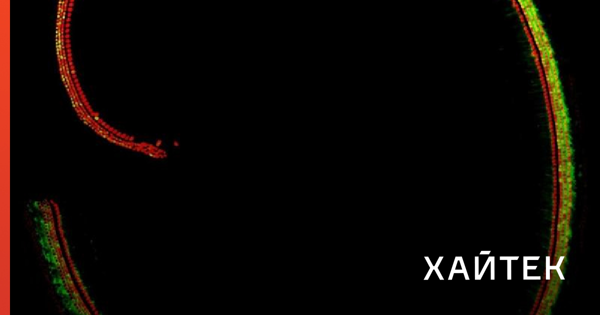 Ученые разработали новый ген для лечения глухоты